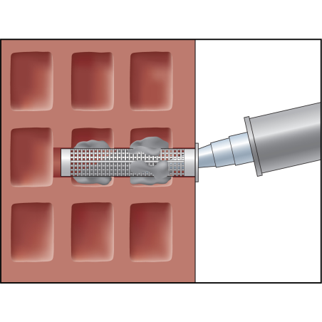 Mounting image ResiFIX 16